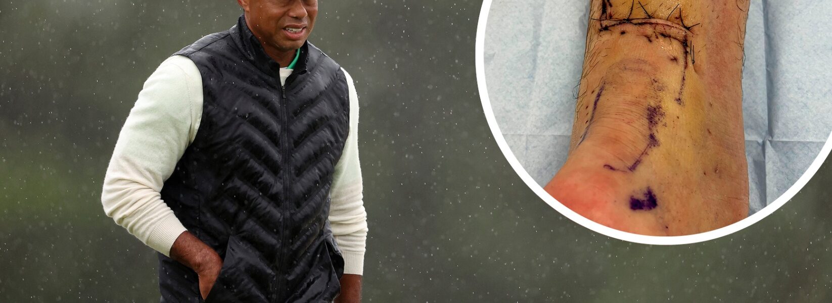 Update on Tiger Woods' injury: It may be until...2026.