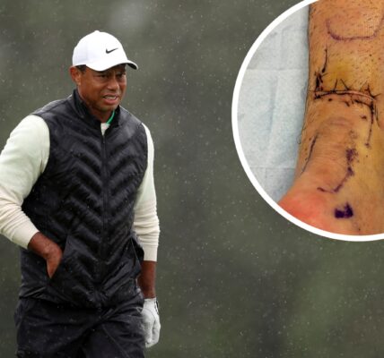Update on Tiger Woods' injury: It may be until...2026.