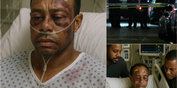 SAD NEWS: Intruder Attacks Tiger Woods in Home Invasion – Legendary Golfer Seriously Injured, Motive for Attack Being Clarified by Authorities