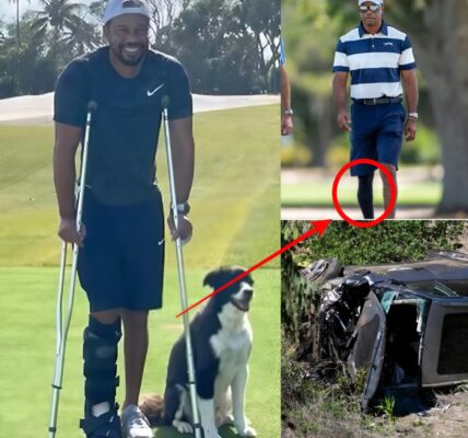 SHOCKING PHOTO Of Tiger Woods On The Golf Course Has Fans Asking Big Questions About The Horrific Injuries He Suffered After A Car Accident...