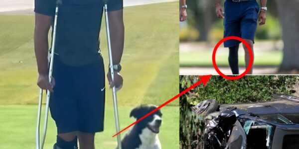 SHOCKING PHOTO Of Tiger Woods On The Golf Course Has Fans Asking Big Questions About The Horrific Injuries He Suffered After A Car Accident...